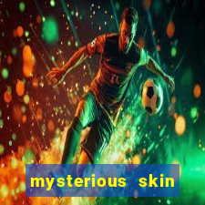 mysterious skin online dublado